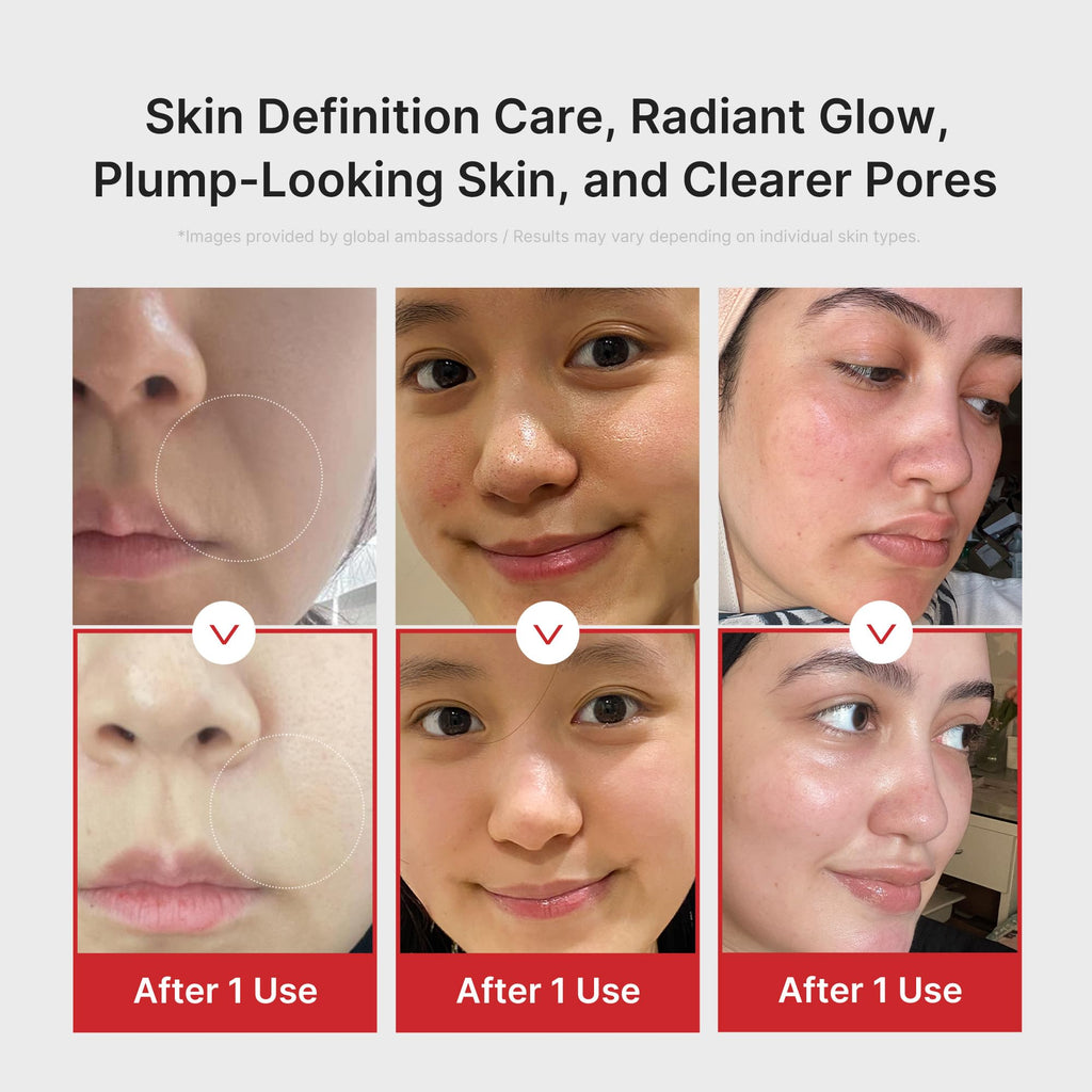 medicube Age-R Booster Pro | 6-in-1 Real Glass Glow Beauty Massager | Looking Glass Skin | Korean Skin Care