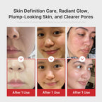 medicube Age-R Booster Pro | 6-in-1 Real Glass Glow Beauty Massager | Looking Glass Skin | Korean Skin Care